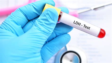 LDH • Das steckt hinter erhöhten Werten .